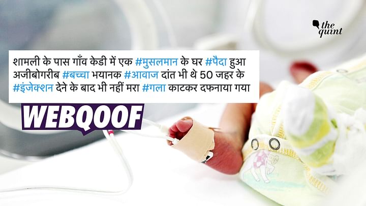 Fact Check: "Alien Baby" Born in UP Town? 91 Clip of Infant With Rare Genetic Condition Shared as ‘Alien’ Baby