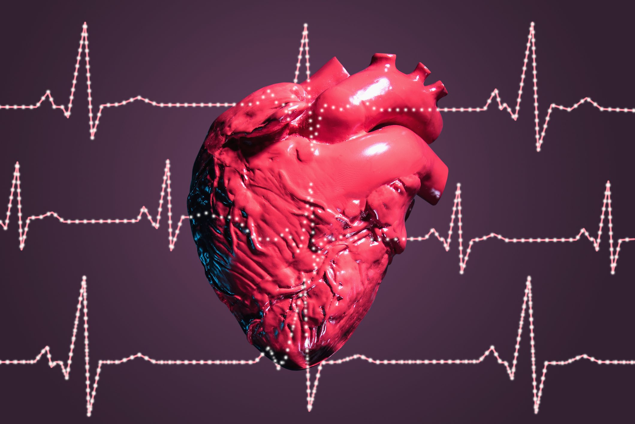 Why Cardiac Deaths During Workouts Have Shot Up? | Dr. Haleema Yezdani Explains | NH Ground Report 104 Cardiac Deaths During Workouts