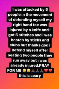 Internet Star Kili Paul Attacked With A Knife 87 Story from Kili Puals Instagram Story Image Source The Indian Express