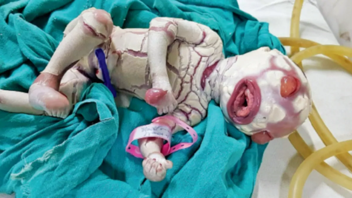 Monster Baby Born In India