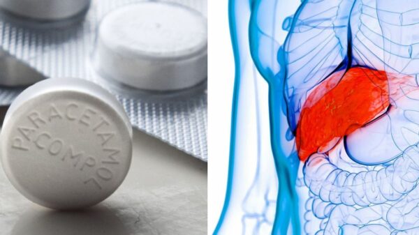 Paracetamol 650 causing Liver Damage