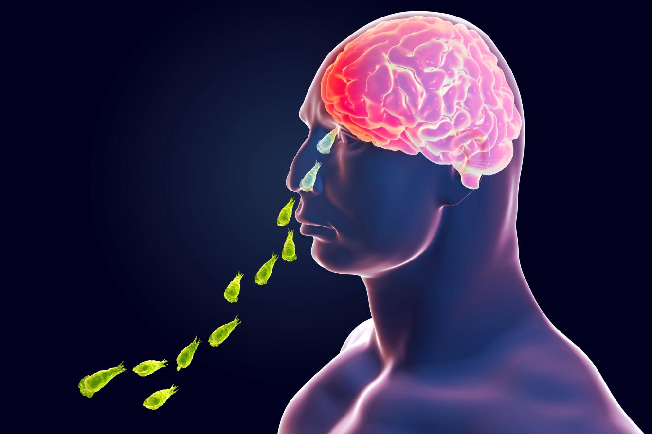 Here's All You Need To Know About The Rare Brain-Eating Amoeba Found In South Korea 88 ‘Unusually deadly’ brain-eating bug hits Florida as docs confirm first ...